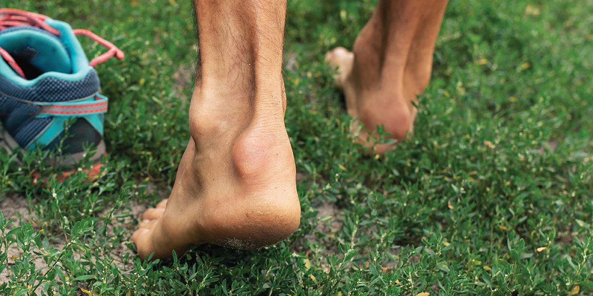 Achilles Tendon Injuries Common Running Injuries